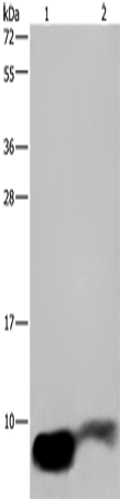 Rabbit Polyclonal Antibody to GNG2