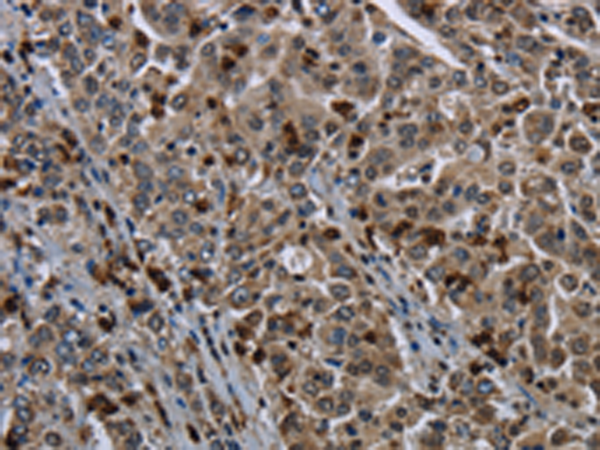 Rabbit Polyclonal Antibody to GP1BA