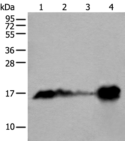 Rabbit Polyclonal Antibody to MB