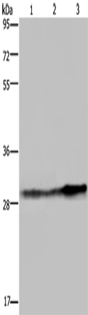 Rabbit Polyclonal Antibody to GSTO1