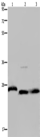 Rabbit Polyclonal Antibody to GSTP1