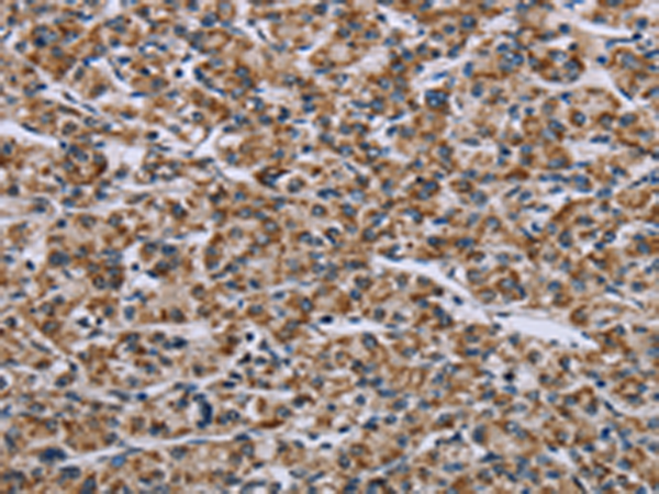 Rabbit Polyclonal Antibody to GTPBP10