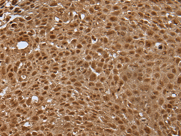 Rabbit Polyclonal Antibody to LAMTOR5