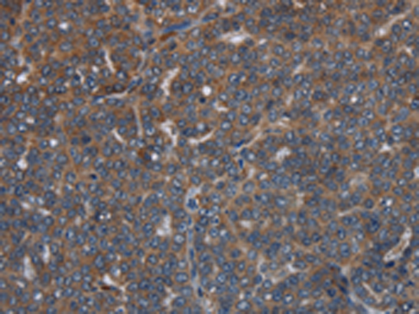 Rabbit Polyclonal Antibody to LETMD1