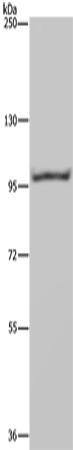Rabbit Polyclonal Antibody to NEDD9