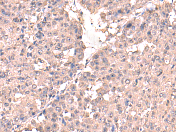 Rabbit Polyclonal Antibody to HPN