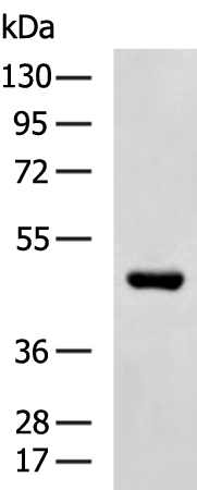 Rabbit Polyclonal Antibody to SUV39H1