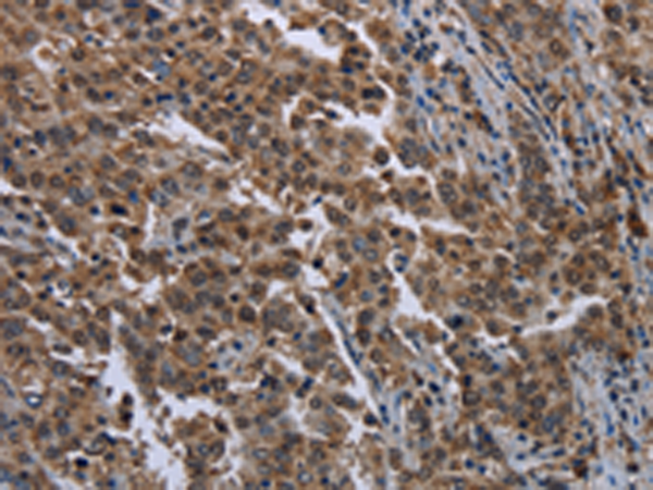 Rabbit Polyclonal Antibody to SETD7