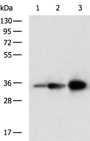 Rabbit Polyclonal Antibody to HMGCL