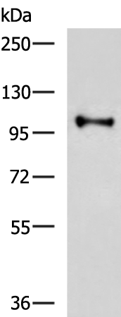 Rabbit Polyclonal Antibody to HMGCR