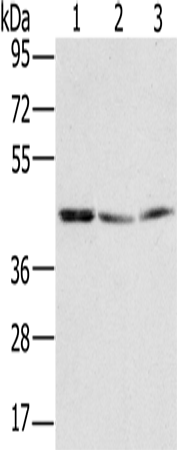 Rabbit Polyclonal Antibody to RBMX