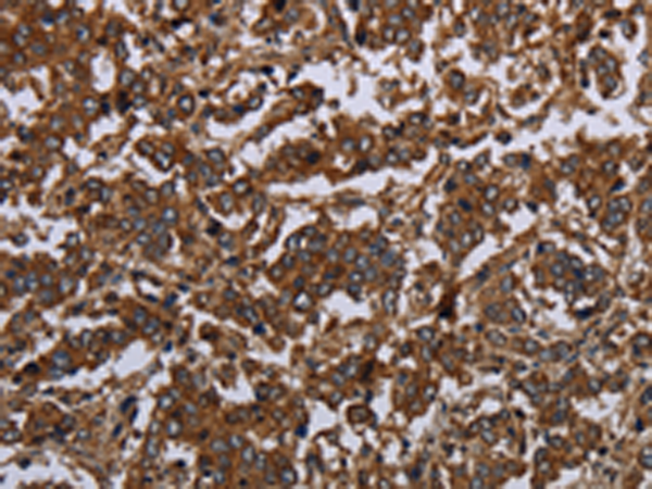 Rabbit Polyclonal Antibody to HOMER2