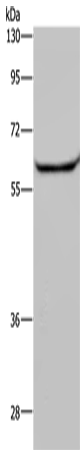 Rabbit Polyclonal Antibody to HACL1