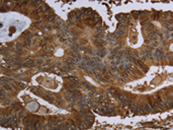 Rabbit Polyclonal Antibody to HPGD