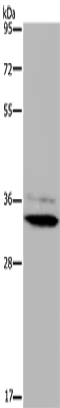 Rabbit Polyclonal Antibody to HSD17B7