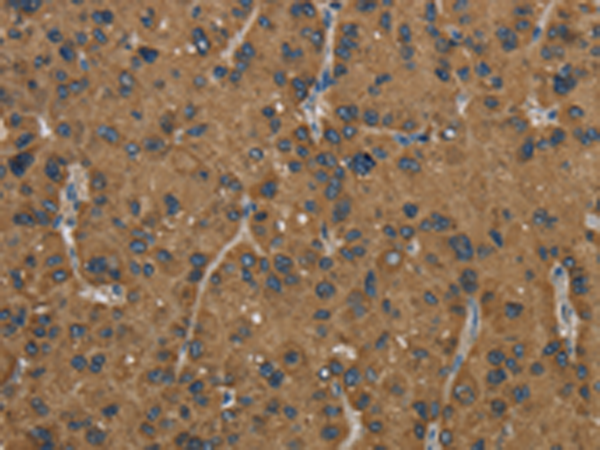 Rabbit Polyclonal Antibody to HSD17B2