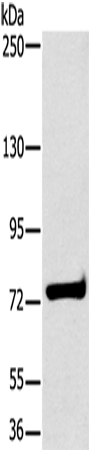 Rabbit Polyclonal Antibody to HSD17B4