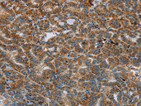 Rabbit Polyclonal Antibody to HSD17B14