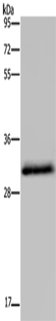 Rabbit Polyclonal Antibody to HSD17B6