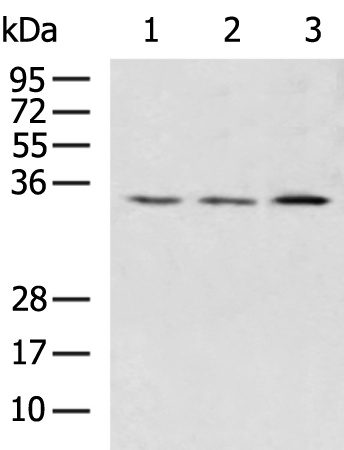 Rabbit Polyclonal Antibody to HSD17B13