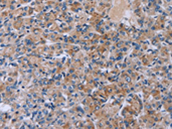 Rabbit Polyclonal Antibody to HSD3B2