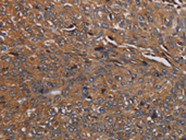Rabbit Polyclonal Antibody to HYAL2