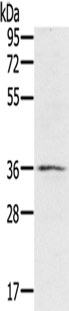 Rabbit Polyclonal Antibody to RNF144B