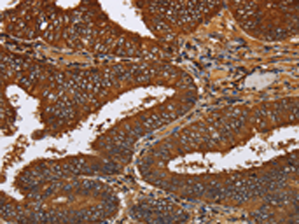 Rabbit Polyclonal Antibody to TICAM2
