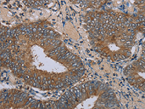 Rabbit Polyclonal Antibody to IFRD1