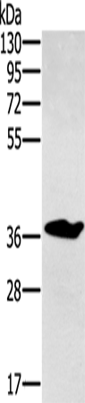 Rabbit Polyclonal Antibody to CCN3