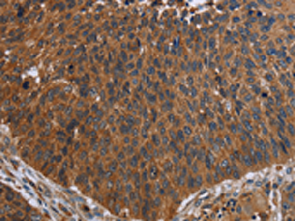 Rabbit Polyclonal Antibody to FCGR3A