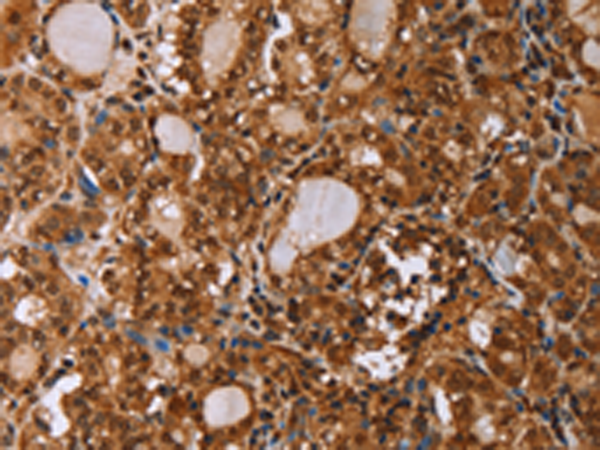 Rabbit Polyclonal Antibody to IHH