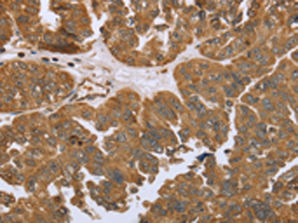 Rabbit Polyclonal Antibody to IKBKE