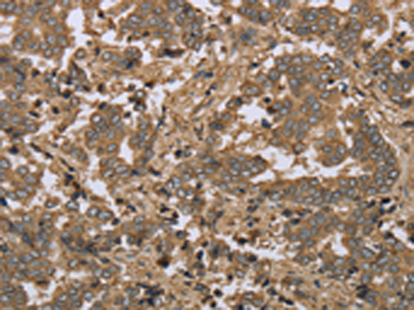 Rabbit Polyclonal Antibody to IKBIP