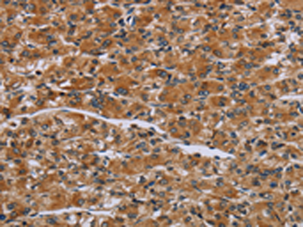 Rabbit Polyclonal Antibody to IL2RG