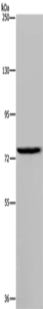 Rabbit Polyclonal Antibody to IL31RA