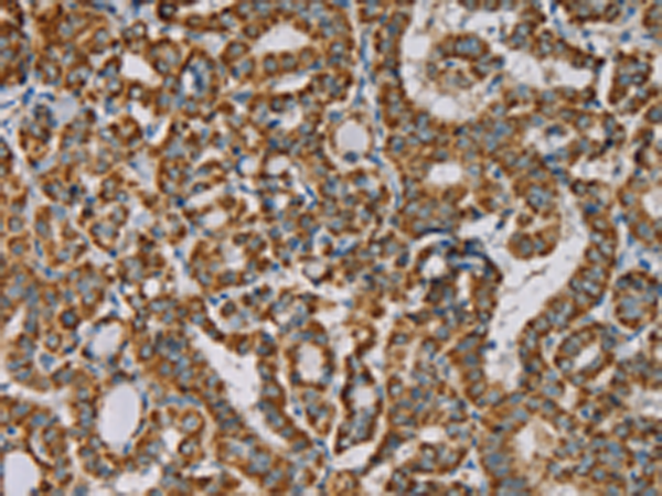 Rabbit Polyclonal Antibody to IPO13