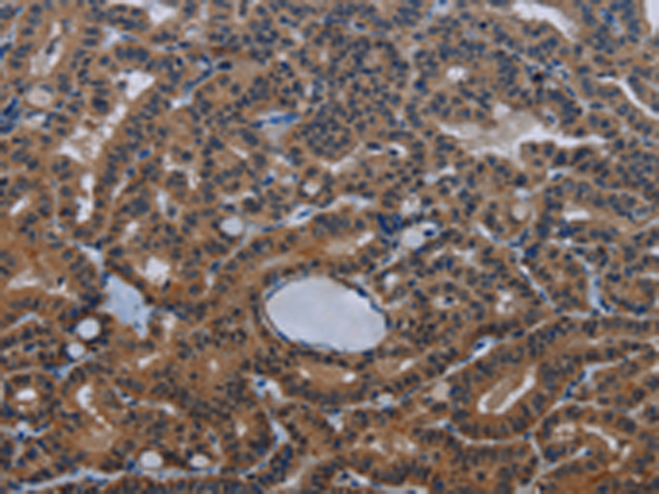 Rabbit Polyclonal Antibody to INSIG2