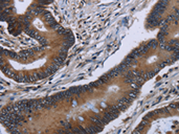 Rabbit Polyclonal Antibody to ITGAE