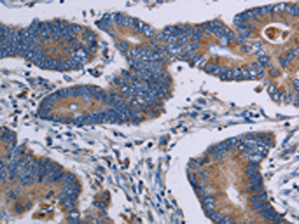 Rabbit Polyclonal Antibody to ITK