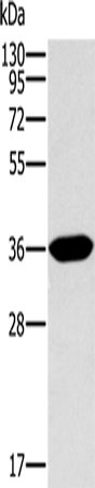 Rabbit Polyclonal Antibody to ITLN1