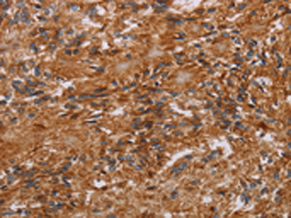 Rabbit Polyclonal Antibody to JAKMIP2