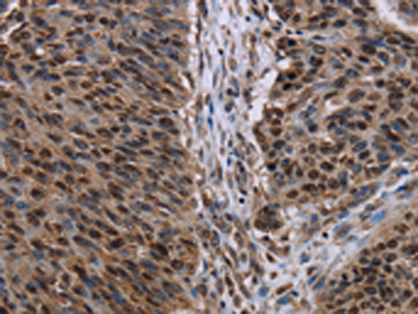 Rabbit Polyclonal Antibody to KDM3B