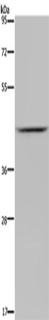 Rabbit Polyclonal Antibody to JMJD6