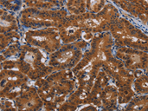 Rabbit Polyclonal Antibody to JMJD7