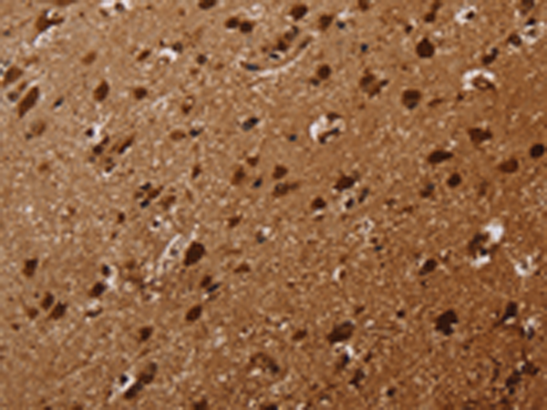 Rabbit Polyclonal Antibody to KARS1