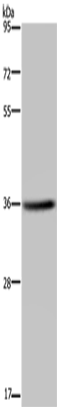 Rabbit Polyclonal Antibody to KCNK17