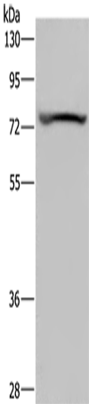 Rabbit Polyclonal Antibody to KCNQ1