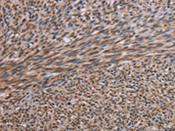 Rabbit Polyclonal Antibody to KIF2A