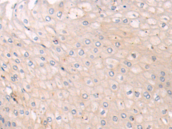 Rabbit Polyclonal Antibody to KLHL1